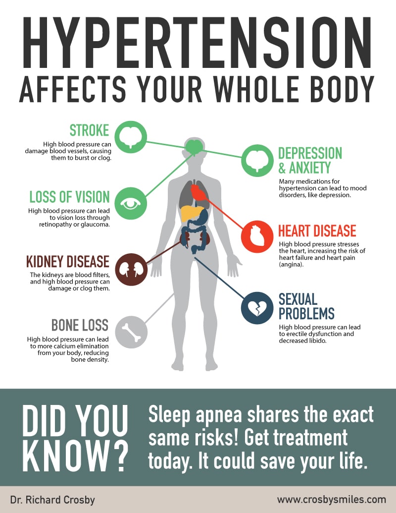 Sleep-Apnea-Infographic-Dr-Richard-Crosby